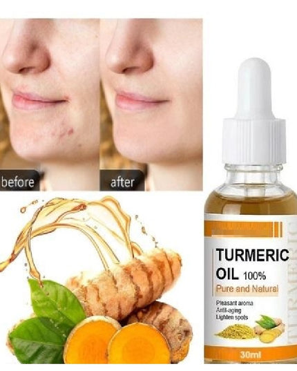 Turmeric Oil 30 ML (Pack of 2)