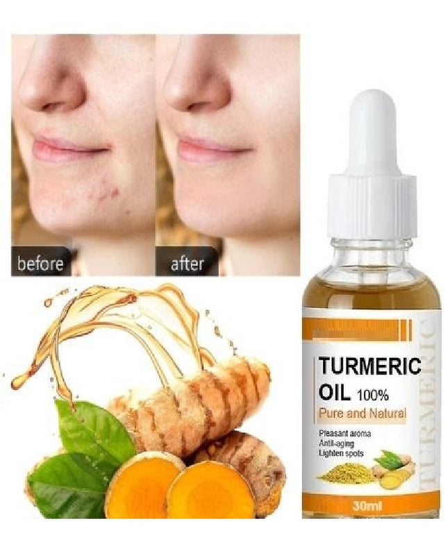 Turmeric Oil 30 ML (Pack of 2)