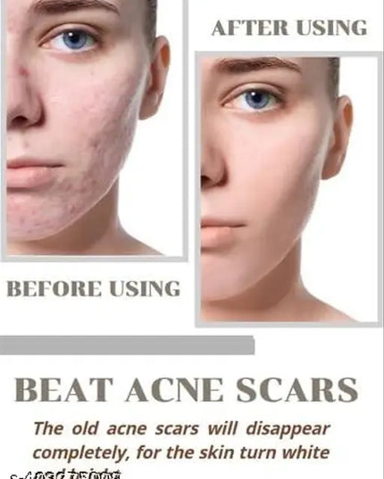 Niacid Face Serum -Skin Brightening & Anti-Aging Formula Repairs and Hydrates (Pack of 1)