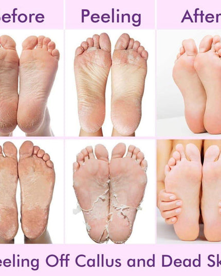 Exfoliating Foot Mask Hydrating Sock Pedicure Essential