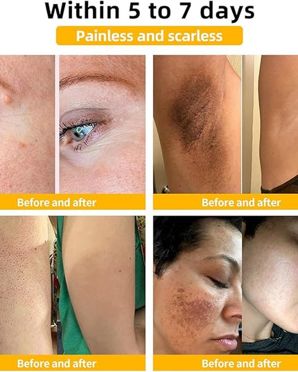 Bee Venom Skin Treatment Cream,Repair Maximum Strength for All Skin Types (2PCS)