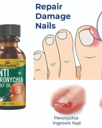 Anti Paronychia Relief Oil 10 ml Pack of 1