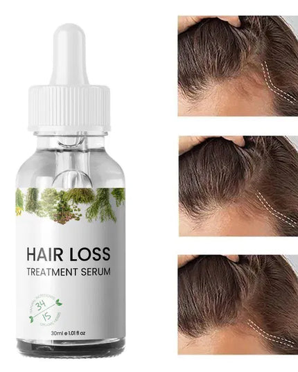 Hair Loss Treatment Serum 30Ml (Pack Of 2)